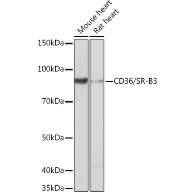 Western Blot - Anti-CD36 Antibody [ARC0461] (A305845) - Antibodies.com