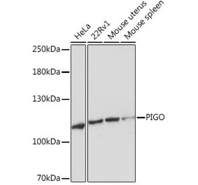 Western Blot - Anti-PIGO Antibody (A305846) - Antibodies.com