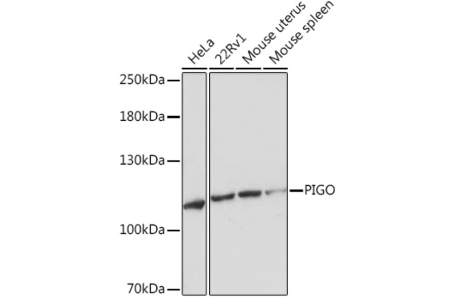 Western Blot - Anti-PIGO Antibody (A305846) - Antibodies.com