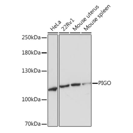 Western Blot - Anti-PIGO Antibody (A305846) - Antibodies.com