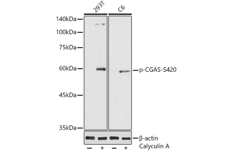 Western Blot - Anti-cGAS (phospho Ser420) Antibody (A305847) - Antibodies.com