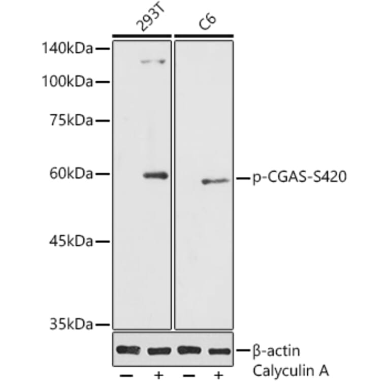 Western Blot - Anti-cGAS (phospho Ser420) Antibody (A305847) - Antibodies.com