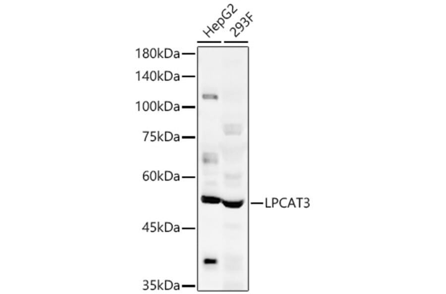 Western Blot - Anti-LPCAT3 Antibody (A305848) - Antibodies.com