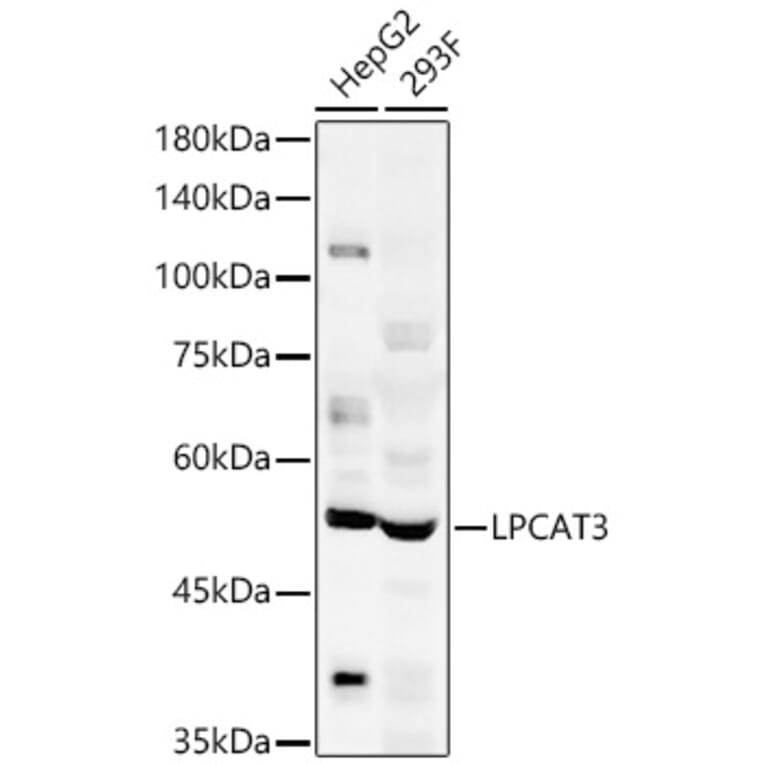 Western Blot - Anti-LPCAT3 Antibody (A305848) - Antibodies.com