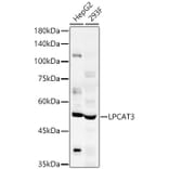 Western Blot - Anti-LPCAT3 Antibody (A305848) - Antibodies.com