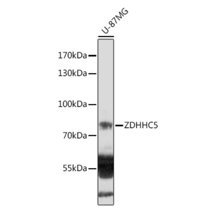 Western Blot - Anti-DHHC-5 Antibody (A305849) - Antibodies.com