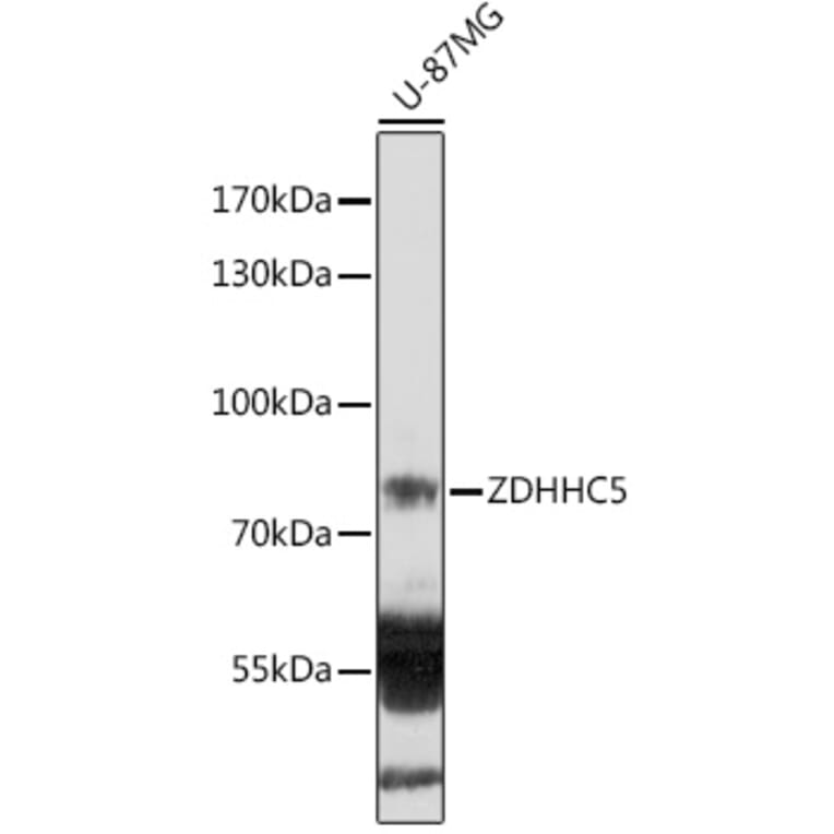 Western Blot - Anti-DHHC-5 Antibody (A305849) - Antibodies.com