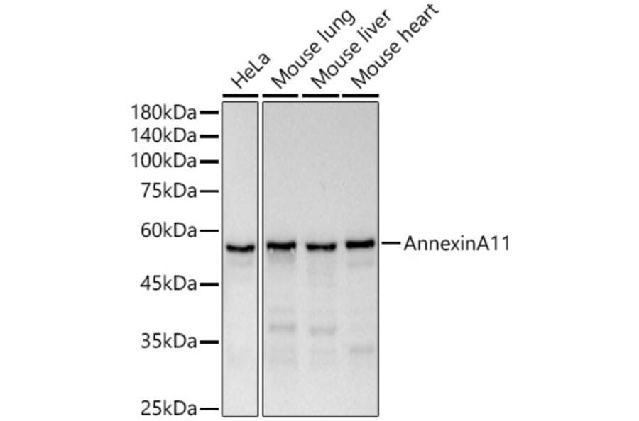 Western Blot - Anti-Annexin-11/ANXA11 Antibody [ARC51481] (A305850) - Antibodies.com
