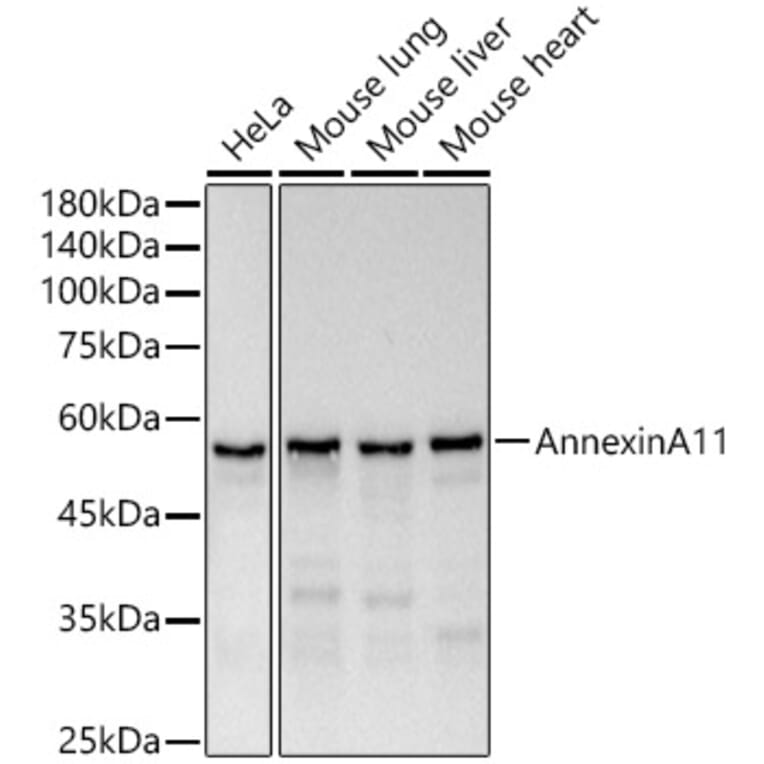 Western Blot - Anti-Annexin-11/ANXA11 Antibody [ARC51481] (A305850) - Antibodies.com
