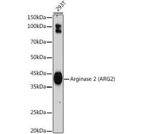 Western Blot - Anti-Arg2 Antibody [ARC2391] (A305851) - Antibodies.com