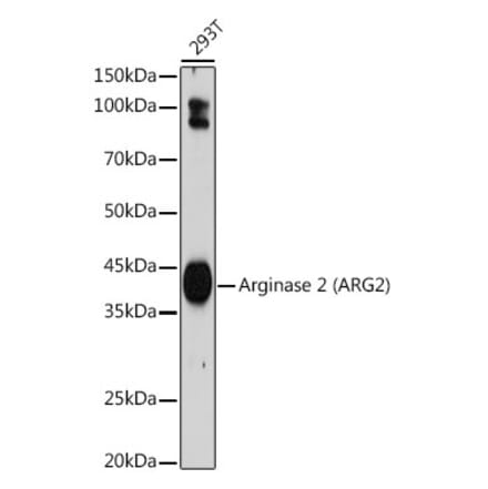 Western Blot - Anti-Arg2 Antibody [ARC2391] (A305851) - Antibodies.com