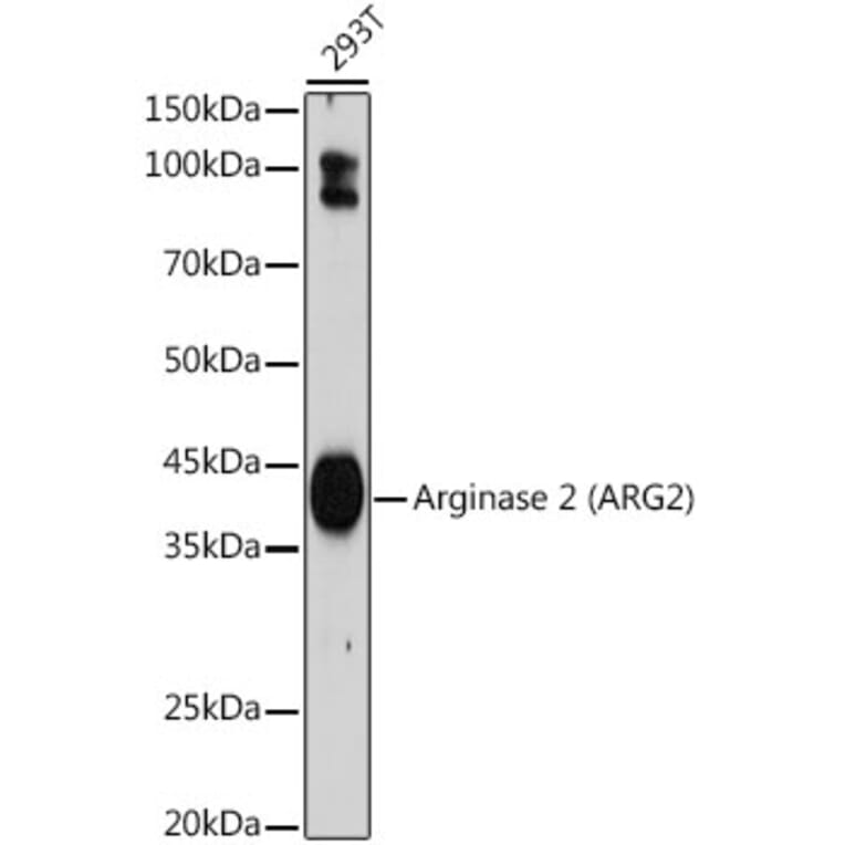 Western Blot - Anti-Arg2 Antibody [ARC2391] (A305851) - Antibodies.com