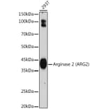 Western Blot - Anti-Arg2 Antibody [ARC2391] (A305851) - Antibodies.com