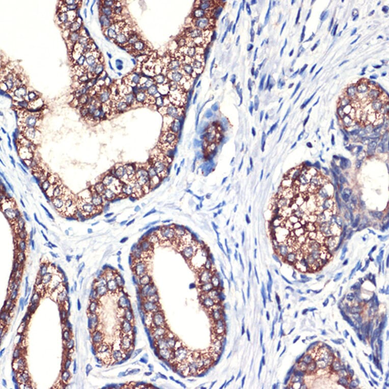 Immunohistochemistry - Anti-Arg2 Antibody [ARC2391] (A305851) - Antibodies.com