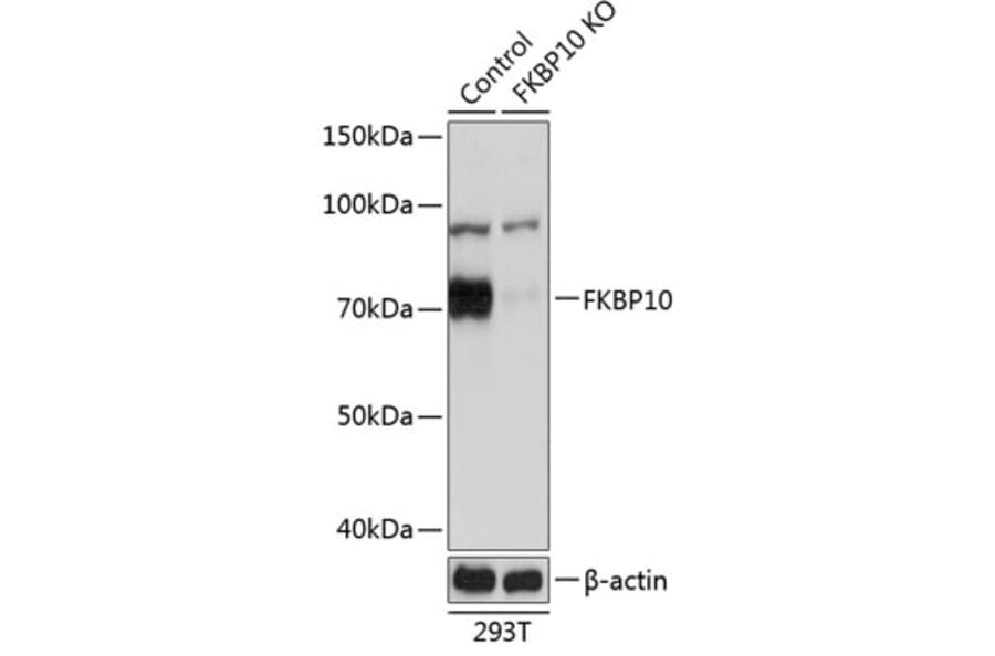 Western Blot - Anti-FKBP10 Antibody (A305852) - Antibodies.com