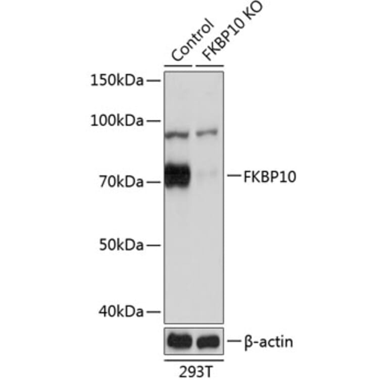 Western Blot - Anti-FKBP10 Antibody (A305852) - Antibodies.com