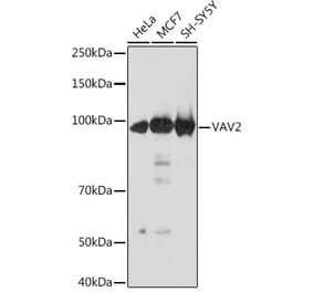 Western Blot - Anti-VAV2 Antibody [ARC2041] (A305853) - Antibodies.com