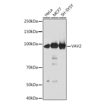 Western Blot - Anti-VAV2 Antibody [ARC2041] (A305853) - Antibodies.com