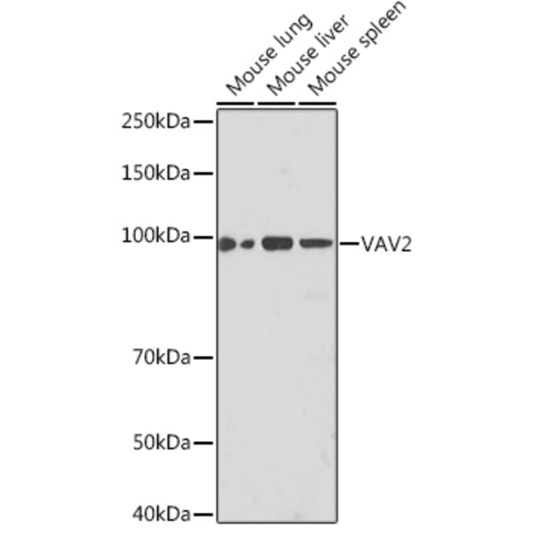 Western Blot - Anti-VAV2 Antibody [ARC2041] (A305853) - Antibodies.com