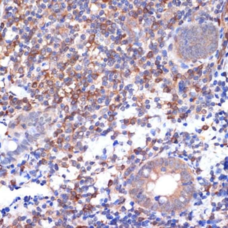 Immunohistochemistry - Anti-VAV2 Antibody [ARC2041] (A305853) - Antibodies.com