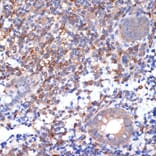 Immunohistochemistry - Anti-VAV2 Antibody [ARC2041] (A305853) - Antibodies.com