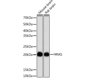 Western Blot - Anti-GTPase HRAS Antibody [ARC0098] (A305855) - Antibodies.com