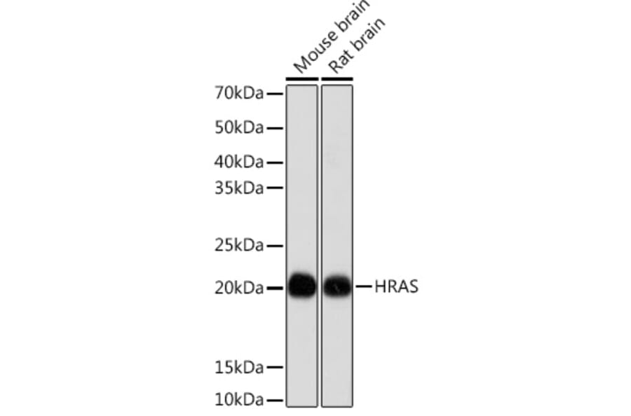 Western Blot - Anti-GTPase HRAS Antibody [ARC0098] (A305855) - Antibodies.com