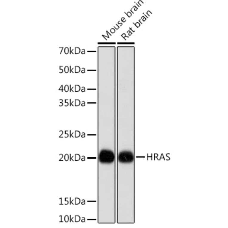 Western Blot - Anti-GTPase HRAS Antibody [ARC0098] (A305855) - Antibodies.com