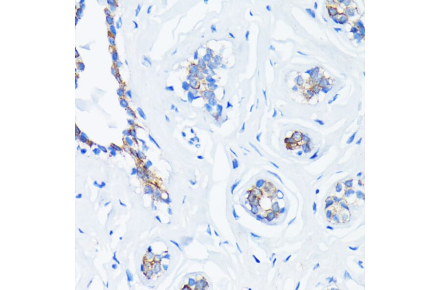 Immunohistochemistry - Anti-GTPase HRAS Antibody [ARC0098] (A305855) - Antibodies.com