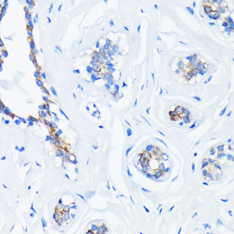 Immunohistochemistry - Anti-GTPase HRAS Antibody [ARC0098] (A305855) - Antibodies.com