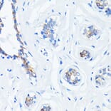 Immunohistochemistry - Anti-GTPase HRAS Antibody [ARC0098] (A305855) - Antibodies.com