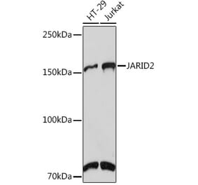 Western Blot - Anti-Jarid2 Antibody [ARC1658] (A305856) - Antibodies.com