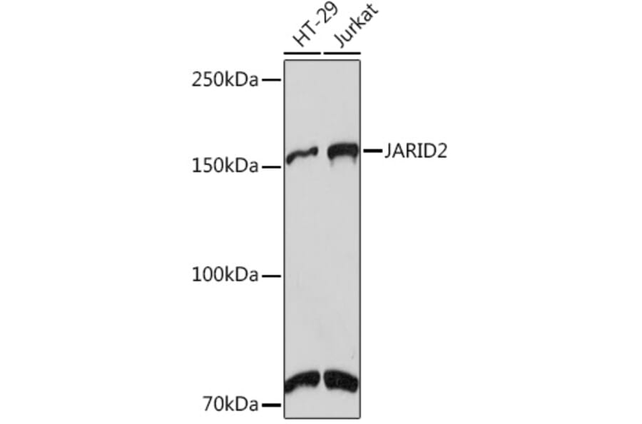 Western Blot - Anti-Jarid2 Antibody [ARC1658] (A305856) - Antibodies.com