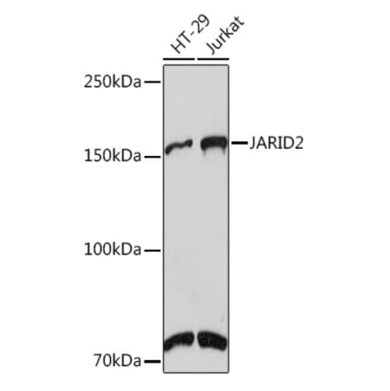 Western Blot - Anti-Jarid2 Antibody [ARC1658] (A305856) - Antibodies.com