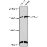 Western Blot - Anti-Jarid2 Antibody [ARC1658] (A305856) - Antibodies.com