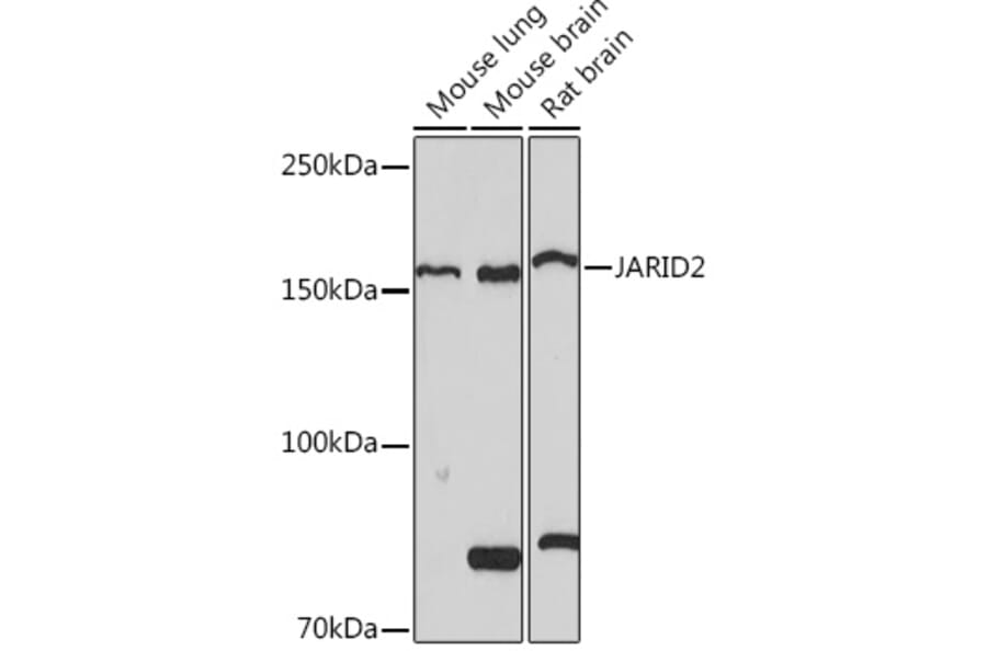 Western Blot - Anti-Jarid2 Antibody [ARC1658] (A305856) - Antibodies.com