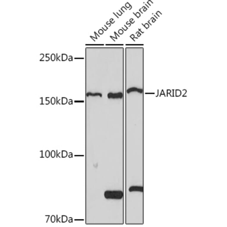 Western Blot - Anti-Jarid2 Antibody [ARC1658] (A305856) - Antibodies.com