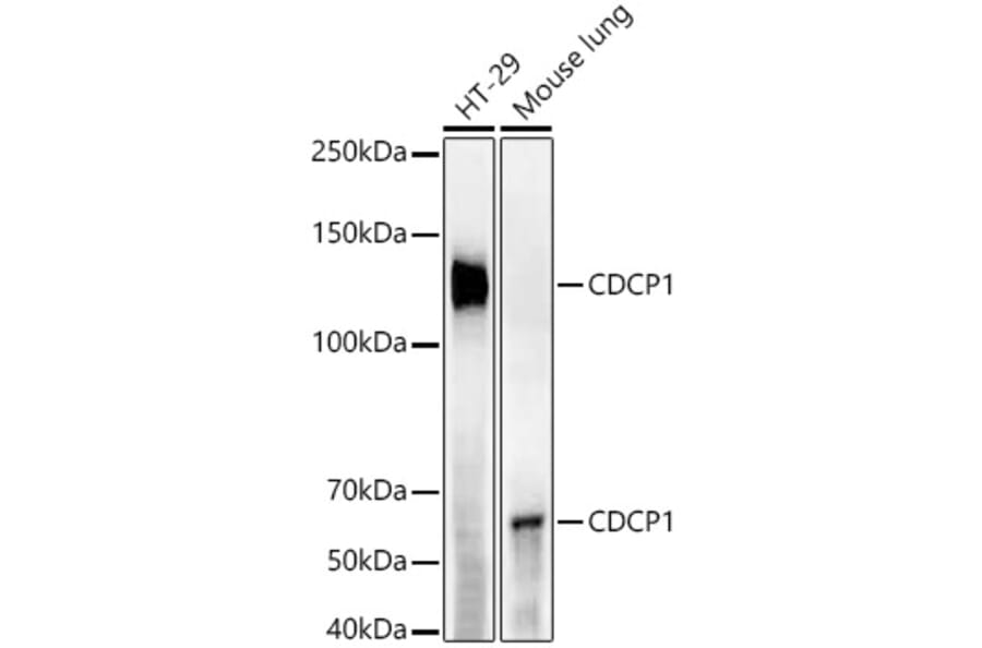 Western Blot - Anti-CDCP1 Antibody [ARC55517] (A305857) - Antibodies.com