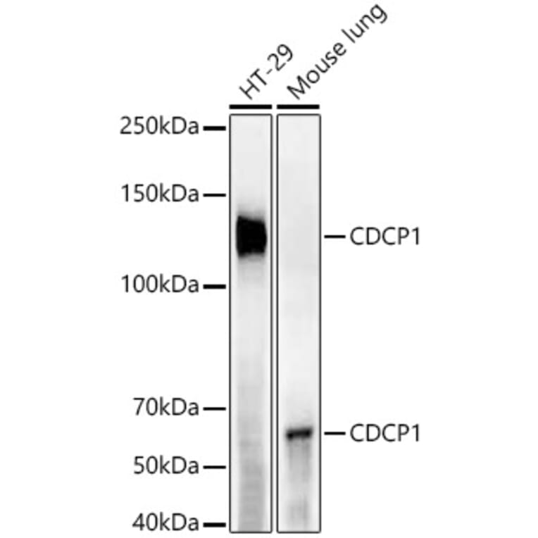 Western Blot - Anti-CDCP1 Antibody [ARC55517] (A305857) - Antibodies.com