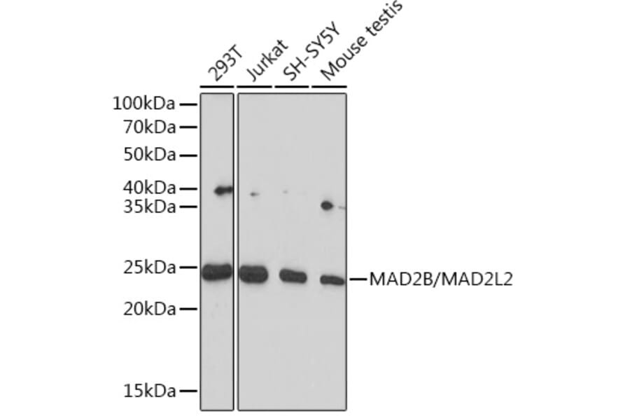 Western Blot - Anti-Mad2L2/REV7 Antibody [ARC1126] (A305858) - Antibodies.com