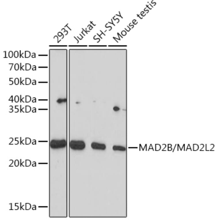 Western Blot - Anti-Mad2L2/REV7 Antibody [ARC1126] (A305858) - Antibodies.com