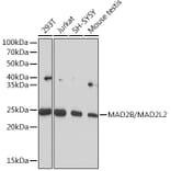 Western Blot - Anti-Mad2L2/REV7 Antibody [ARC1126] (A305858) - Antibodies.com