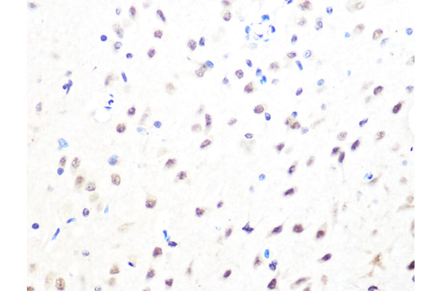 Immunohistochemistry - Anti-Mad2L2/REV7 Antibody [ARC1126] (A305858) - Antibodies.com