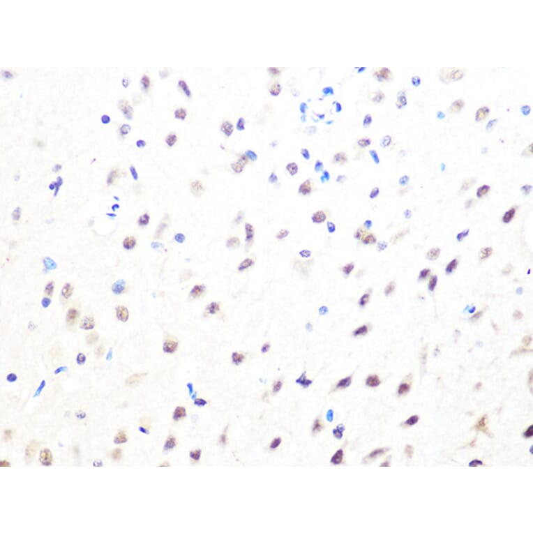 Immunohistochemistry - Anti-Mad2L2/REV7 Antibody [ARC1126] (A305858) - Antibodies.com