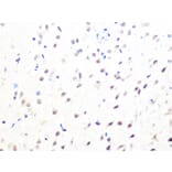 Immunohistochemistry - Anti-Mad2L2/REV7 Antibody [ARC1126] (A305858) - Antibodies.com