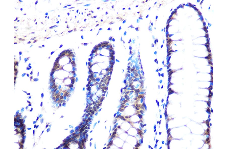 Immunohistochemistry - Anti-Mad2L2/REV7 Antibody [ARC1126] (A305858) - Antibodies.com