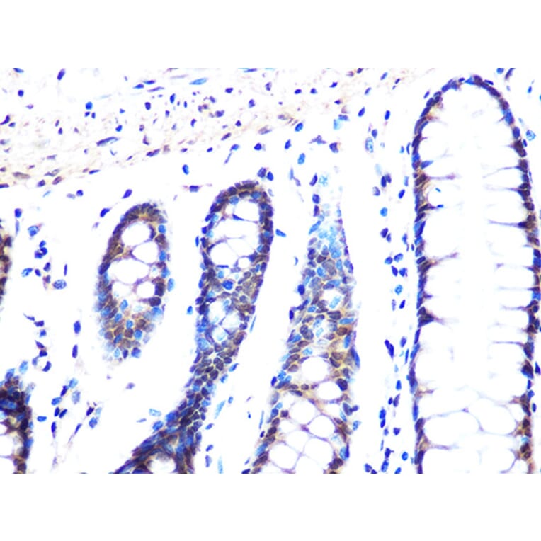 Immunohistochemistry - Anti-Mad2L2/REV7 Antibody [ARC1126] (A305858) - Antibodies.com