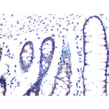 Immunohistochemistry - Anti-Mad2L2/REV7 Antibody [ARC1126] (A305858) - Antibodies.com