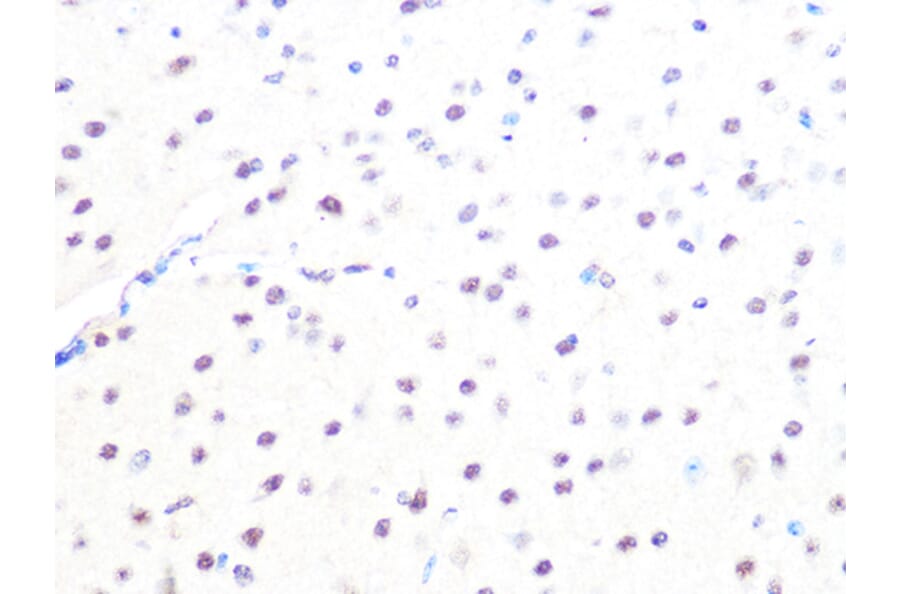 Immunohistochemistry - Anti-Mad2L2/REV7 Antibody [ARC1126] (A305858) - Antibodies.com