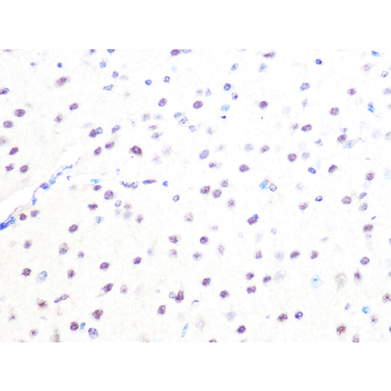 Immunohistochemistry - Anti-Mad2L2/REV7 Antibody [ARC1126] (A305858) - Antibodies.com